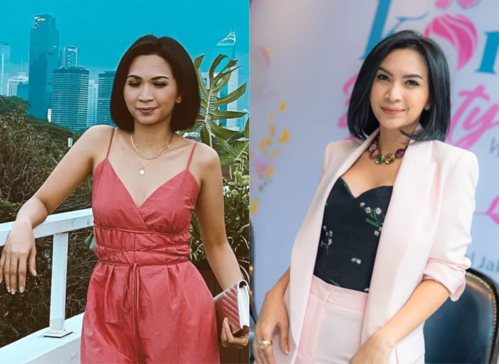 Before-After