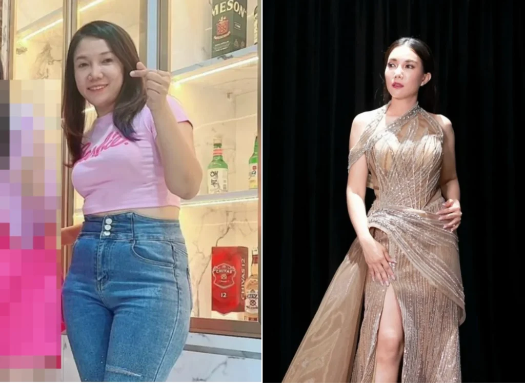 Before-After