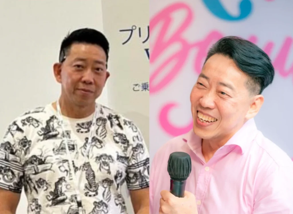 Before-After