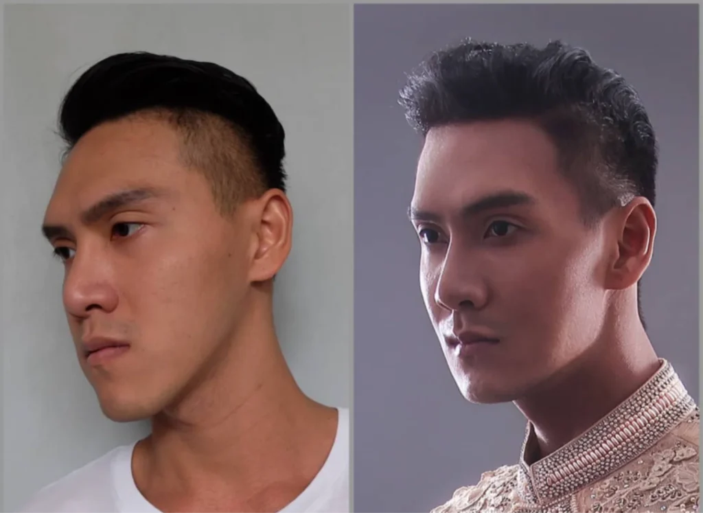 before-After